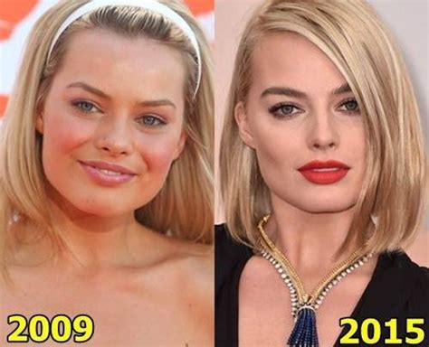 margot robbie before and after surgery|Margot Robbie Before and After Plastic Surgery